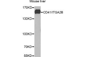 Western blot analysis of extracts of mouse liver, using CD41/CD41/ITGB antibody (ABIN6129287, ABIN6142560, ABIN6142562 and ABIN6221333) at 1:1000 dilution. (Integrin Alpha2b antibody  (AA 693-993))