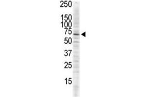 Western Blotting (WB) image for anti-Calcium/calmodulin-Dependent Protein Kinase II delta (CAMK2D) antibody (ABIN5023065) (CAMK2D antibody)