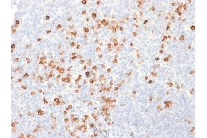 ABIN6383781 to pan-IgG was successfully used to stain IgG-expressing B cells in human tonsil sections.
