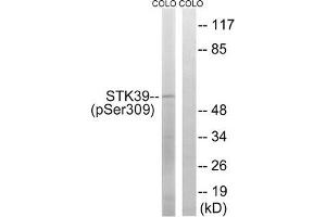 Western blot analysis of extracts from COLO cells using STK39 (Phospho-Ser309) Antibody. (STK39 antibody  (pSer311))