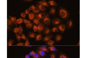 Immunofluorescence (IF) image for anti-Adenosine A2a Receptor (ADORA2A) antibody (ABIN7258746)