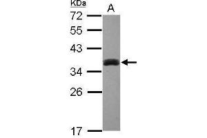 WB Image Sample (30 ug of whole cell lysate) A: HepG2 12% SDS PAGE antibody diluted at 1:1000 (SULT1A3 antibody  (Center))