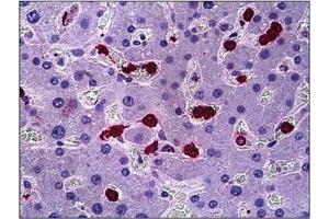 Human Liver: Formalin-Fixed, Paraffin-Embedded (FFPE) (HGS antibody  (Internal Region))