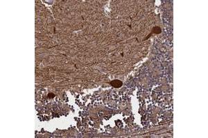 Immunohistochemical staining of human cerebellum with PLP2 polyclonal antibody  shows strong cytoplasmic positivity in purkinje cells at 1:50-1:200 dilution.