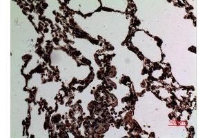 Immunohistochemistry (IHC) analysis of paraffin-embedded Rat Lung, antibody was diluted at 1:100. (STAT2 antibody  (Tyr1221, Tyr1222))