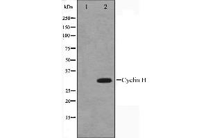 Western blot analysis on HeLa cell lysate using Cyclin H Antibody. (Cyclin H antibody  (C-Term))