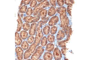 Immunohistochemistry of paraffin-embedded rat kidney using NEK6 Rabbit mAb (ABIN7268916) at dilution of 1:100 (40x lens). (NEK6 antibody)