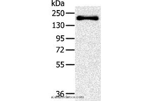 Western blot analysis of Mouse bladder tissue, using SLIT2 Polyclonal Antibody at dilution of 1:200
