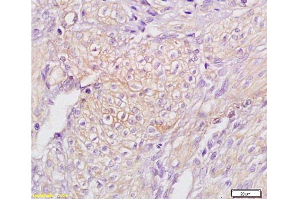 TAP2 antibody  (AA 451-550)