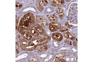 Immunohistochemical staining of human kidney with CILP2 polyclonal antibody  shows moderate cytoplasmic positivity in cells in tubules at 1:200-1:500 dilution.