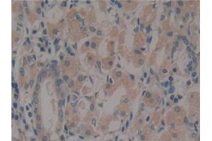 Immunohistochemistry (IHC) image for anti-Paxillin (PXN) (AA 201-461) antibody (ABIN7434188)