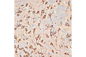 Immunohistochemistry of paraffin-embedded rat brain using Musashi-2 (Musashi-2 (MSI2)) Rabbit mAb (ABIN7268701) at dilution of 1:100 (40x lens). (MSI2 antibody)