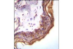 Immunohistochemical staining of formalin fixed and paraffin embedded human skin was performed with KLK7 polyclonal antibody  at 1:10-1:50 dilution followed by indirect peroxidase conjugation with secondary antibody and DAB staining. (Kallikrein 7 antibody  (Internal Region))