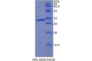 SDS-PAGE analysis of Mouse Coagulation Factor V Protein. (Coagulation Factor V Protein (F5))
