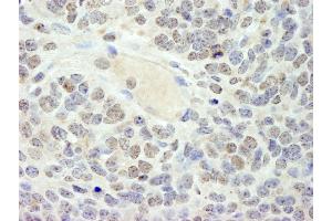 Immunohistochemistry (IHC) image for anti-High Mobility Group Box 3 (HMGB3) (AA 125-175) antibody (ABIN7448596)