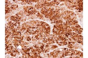 IHC-P Image Immunohistochemical analysis of paraffin-embedded SW480 xenograft, using Cystatin S, antibody at 1:100 dilution. (CST4 antibody  (N-Term))