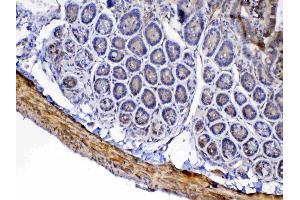 IHC analysis of Factor D using anti-Factor D antibody . (Adipsin antibody  (AA 26-253))