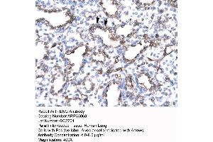 Human Lung (Endoglin antibody  (N-Term))