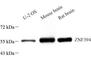 Western blot analysis of ZNF394 (ABIN7076266) at dilution of 1: 1500 (ZNF394 antibody)
