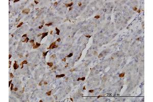 Immunoperoxidase of monoclonal antibody to TSSK2 on formalin-fixed paraffin-embedded human pancreas. (TSSK2 antibody  (AA 265-358))