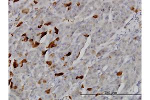 Immunoperoxidase of monoclonal antibody to TSSK2 on formalin-fixed paraffin-embedded human pancreas.