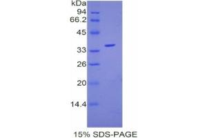 SDS-PAGE analysis of Mouse Coagulation Factor V Protein.