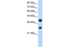 WB Suggested Anti-PCBP2 Antibody Titration:  1. (PCBP2 antibody  (Middle Region))