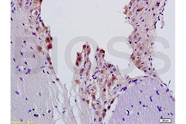 beta 2 Adrenergic Receptor antibody  (AA 201-300)