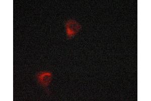 ABIN6268921 staining LOVO cells by ICC/IF. (HSPD1 antibody)