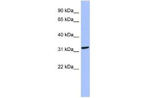 WB Suggested Anti-MAGEB2 Antibody Titration: 0.