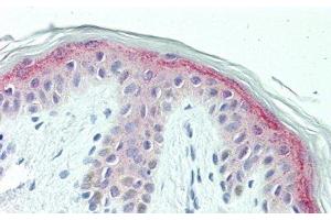 Detection of CSPG4 in Human Skin Tissue using Polyclonal Antibody to Chondroitin Sulfate Proteoglycan 4 (CSPG4) (NG2 antibody  (AA 1919-2258))