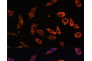 Immunofluorescence analysis of L929 cells using RAB5B Polyclonal Antibody at dilution of 1:100.
