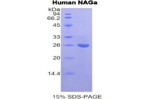 SDS-PAGE analysis of Human NAGa Protein.