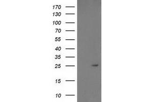 HEK293T cells were transfected with the pCMV6-ENTRY control (Left lane) or pCMV6-ENTRY PDF (Right lane) cDNA for 48 hrs and lysed. (GDF15 antibody)