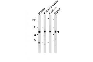 All lanes : Anti-Mouse Csf1r Antibody (C-term) at 1:1000-2000 dilution Lane 1: Mouse heart tissue lysate Lane 2: Mouse skeletal muscle tissue lysate Lane 3: Mouse spleen tissue lysate Lane 4: Rat brain tissue lysate Lysates/proteins at 20 μg per lane. (CSF1R antibody  (C-Term))