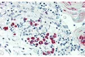 Detection of LTb in Human Thymus Tissue using Polyclonal Antibody to Lymphotoxin Beta (LTb) (LTB antibody  (AA 58-304))