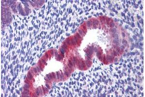 Human Uterus: Formalin-Fixed, Paraffin-Embedded (FFPE) (IDH1 antibody  (C-Term))