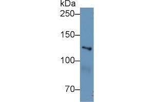 Western Blot; Sample: Human Hela cell lysate; Primary Ab: 1µg/ml Rabbit Anti-Mouse MYO1E Antibody Second Ab: 0.