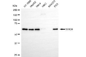 anti-serine threonine Kinase 39 (STK39) antibody