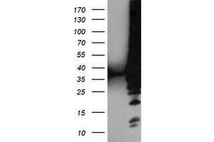 Western Blotting (WB) image for anti-Low Density Lipoprotein Receptor Adaptor Protein 1 (LDLRAP1) antibody (ABIN1496690) (LDLRAP1 antibody)