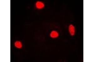 Immunofluorescent analysis of RNF40 staining in MCF7 cells.