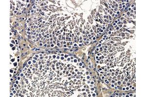ABIN7097097 and ABIN7101164 at 1/100 staining rat testis tissue by IHC-P.
