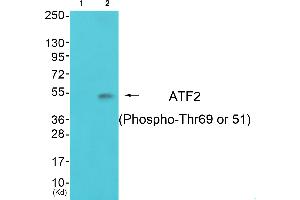 Western blot analysis of extracts from 3T3 cells, using ATF-2 (Phospho-Thr69 or 51) Antibody.