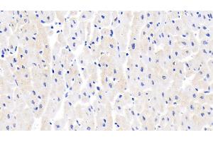 Detection of GLUT4 in Human Cardiac Muscle Tissue using Polyclonal Antibody to Glucose Transporter 4 (GLUT4) (GLUT4 antibody  (AA 228-292))