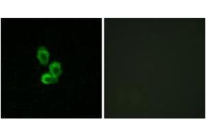 Immunofluorescence analysis of HepG2 cells, using PDGF Receptor beta (Ab-751) Antibody. (PDGFRB antibody  (AA 718-767))