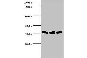 Western blot All lanes: Adenylate kinase 2, mitochondrial antibody at 5 μg/mL Lane 1: Hela whole cell lysate Lane 2: Mouse kidney tissue Lane 3: Mouse small intestine tissue Secondary Goat polyclonal to rabbit IgG at 1/10000 dilution Predicted band size: 27, 26, 23, 15, 25, 22 kDa Observed band size: 27 kDa (Adenylate Kinase 2 antibody  (AA 1-232))