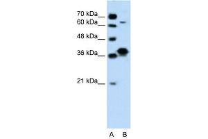 WB Suggested Anti-FOSL1 Antibody Titration: 0. (FOSL1 antibody  (Middle Region))