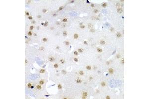 Immunohistochemistry of paraffin-embedded mouse brain using CDC27 antibody (ABIN5975347) at dilution of 1/200 (40x lens). (CDC27 antibody)