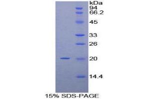 SDS-PAGE (SDS) image for CD69 (CD69) (AA 43-187) protein (His tag) (ABIN1878956) (CD69 Protein (CD69) (AA 43-187) (His tag))