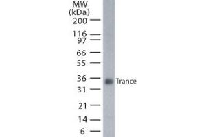 Image no. 1 for anti-Tumor Necrosis Factor (Ligand) Superfamily, Member 11 (TNFSF11) (AA 1-317) antibody (ABIN208247) (RANKL antibody  (AA 1-317))